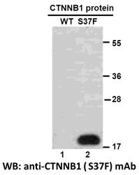 Anti-CTNNB1 (S37F) Mouse Monoclonal Antibody, 100 µl (26168), NEBA10185 Anti-CTNNB1 (S37F) Mouse Monoclonal Antibody, 100 µl (26168), NEBA10185