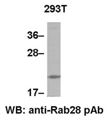 Anti-Rab28 Rabbit Polyclonal Antibody, 100 µl (21061), NEBA10039