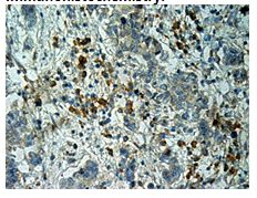 Anti-ERBB2 Rabbit polyclonal Antibody, C-terminal immunogen, 100 µl (21200), NEBA10074 Anti-ERBB2 Rabbit polyclonal Antibody, C-terminal immunogen, 100 µl (21200), NEBA10074