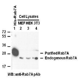 Anti-Rab7A Rabbit Polyclonal Antibody, 100 µl (21069), NEBA10043
