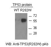 Anti-TP53 (R282W) Rabbit Polyclonal Antibody, 100 µl (21165), NEBA10073