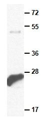 Anti-Rab7 Mouse Monoclonal Antibody, 100 µl (26055), NEBA10134 Anti-Rab7 Mouse Monoclonal Antibody, 100 µl (26055), NEBA10134