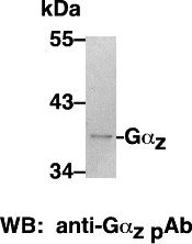 Anti-Gαz Rabbit Polyclonal Antibody, 100 µl (21016), NEBA10013