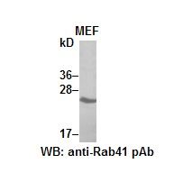 Anti-Rab41 Rabbit Polyclonal Antibody, 100 µl (21084), NEBA10050