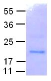 Rab11 Protein, 10 µg (10126) NEBCC0041