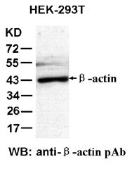 Anti-β-actin Rabbit Polyclonal Antibody, 100 µl (21011), NEBA10008