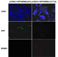 Anti-ErbB2 (V777A) mouse monoclonal Antibody, 100 µl (26080), NEBA1045
