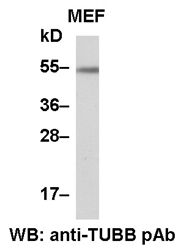 Anti-β-Tubulin Rabbit Polyclonal Antibody, 100 µl (21089), NEBA10051