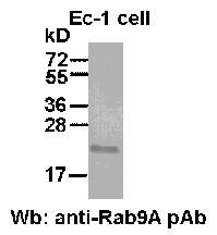 Anti-Rab9A Rabbit Polyclonal Antibody, 100 µl (21073), NEBA10045