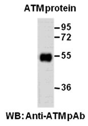 Anti-ATM Rabbit Polyclonal Antibody, 100 µl (21276), NEBA10090