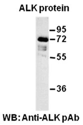 Anti-ALK Rabbit Polyclonal Antibody, 100 µl (21280), NEBA10093
