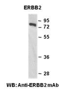 Anti-ERBB2 Mouse Monoclonal Antibody, 100 µl (26127), NEBA10163