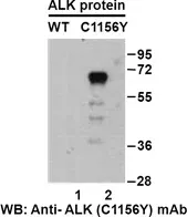 Anti-ALK (C1156Y) Mouse Monoclonal Antibody, 100 µl (26226), NEBA10200