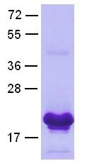 Rab5 Protein, 100 µg (10116) NEBCC0021