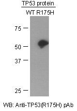Anti-TP53 (R175H) Rabbit Polyclonal Antibody, 100 µl (21161), NEBA10072