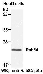 Anti-Rab8A Rabbit Polyclonal Antibody, 100 µl (21071), NEBA10044 Anti-Rab8A Rabbit Polyclonal Antibody, 100 µl (21071), NEBA10044