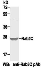 Anti-Rab3C Rabbit Polyclonal Antibody, 100 µl (21043), NEBA10030