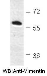 Anti-Vimentin Mouse Monoclonal Antibody, internal immunogen, 100 µl (26054), NEBA10133