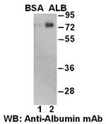 Anti-Albumin Mouse Monoclonal Antibody, 100 µl (26090), NEBA10152