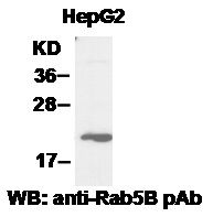 Anti-Rab5B Rabbit Polyclonal Antibody, 100 µl (21037), NEBA10025