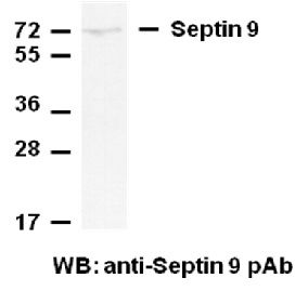 Anti-Septin 9 Rabbit Polyclonal Antibody, 100 µl (21126), NEBA10062