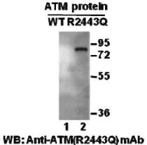 Anti-ATM (R2443Q) Mouse Monoclonal Antibody, 100 µl (26143), NEBA10175