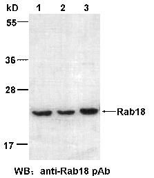 Anti-Rab18 Rabbit Polyclonal Antibody, 100 µl (21050), NEBA10035 Anti-Rab18 Rabbit Polyclonal Antibody, 100 µl (21050), NEBA10035