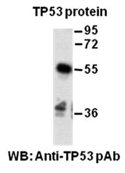 Anti-TP53 Rabbit Polyclonal Antibody, 100 µl (21270), NEBA10086