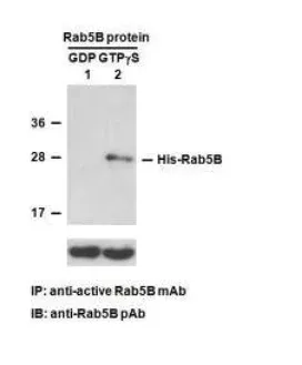 Rab5B Activation Assay Kit, 30 Assays (83401) NEBB40032 Rab5B Activation Assay Kit, 30 Assays (83401) NEBB40032