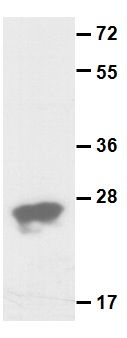 Anti-Rap1B Rabbit Polyclonal Antibody, 100 µl (21156), NEBA10068