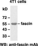 Anti-Fascin Mouse Monoclonal Antibody, N-terminal immunogen, 100 µl (26012), NEBA10107