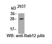 Anti-Rab12 Rabbit Polyclonal Antibody, 100 µl (21076), NEBA10046
