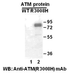 Anti-ATM (R3008H) Mouse Monoclonal Antibody, 100 µl (26140), NEBA10172