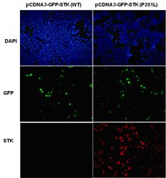 Anti-STK11 Mouse Monoclonal Antibody, 100 µl (26158), NEBA10178 Anti-STK11 Mouse Monoclonal Antibody, 100 µl (26158), NEBA10178