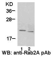 Anti-Rab2A Rabbit Polyclonal Antibody, 100 µl (21039), NEBA10027 Anti-Rab2A Rabbit Polyclonal Antibody, 100 µl (21039), NEBA10027