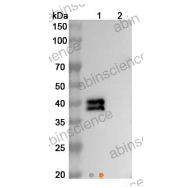 InVivoMAb Anti-RSV/MPV Fusion glycoprotein Neutralizing Antibody_100UG (M2B6) (VK421090-100UG)