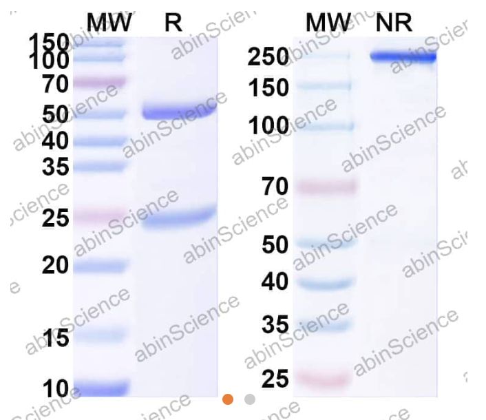 InVivoMAb Anti-RSV/MPV Fusion glycoprotein Neutralizing Antibody (M2D2) (VK421100-100UG) InVivoMAb Anti-RSV/MPV Fusion glycoprotein Neutralizing Antibody (M2D2) (VK421100-100UG)