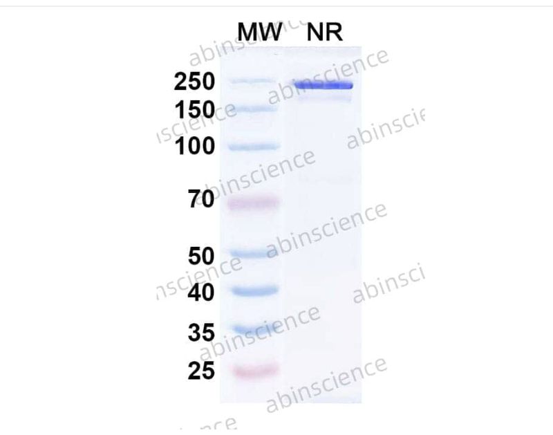 AbinScience InVivoMAb Anti-MPV Prefusion F glycoprotein/Pre-F Antibody (MPV458) (VK430010-100UG) AbinScience InVivoMAb Anti-MPV Prefusion F glycoprotein/Pre-F Antibody (MPV458) (VK430010-100UG)