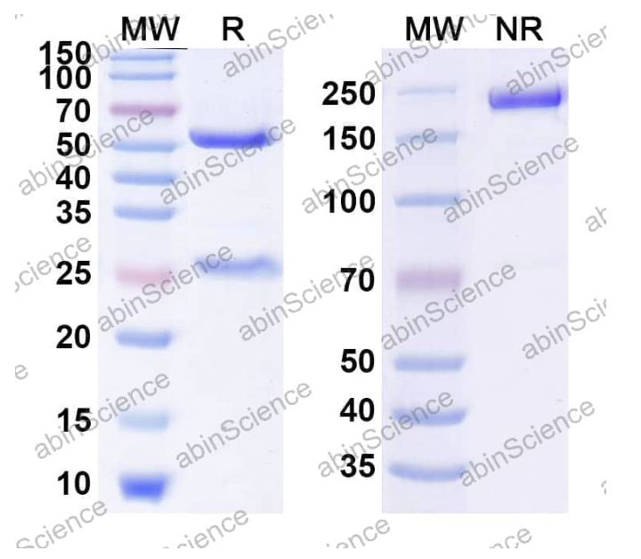 AbinSicence InVivoMAb Anti-hMPV Pre-F Antibody (MPV465) [MPV465] (VK430020-100UG)