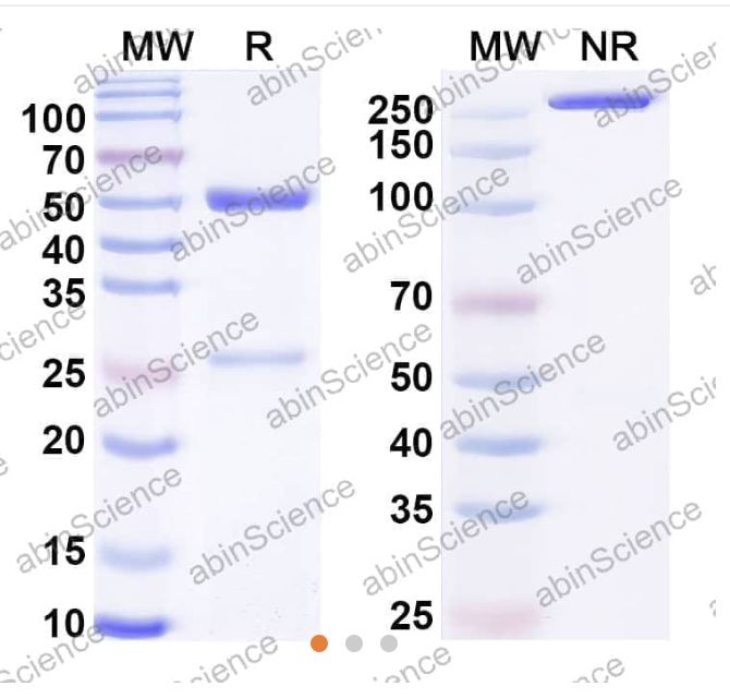 AbinScience InVivoMAb Anti-HCMV/HHV-5 gB Neutralizing Antibody (1G2) (VK665030-100UG) AbinScience InVivoMAb Anti-HCMV/HHV-5 gB Neutralizing Antibody (1G2) (VK665030-100UG)