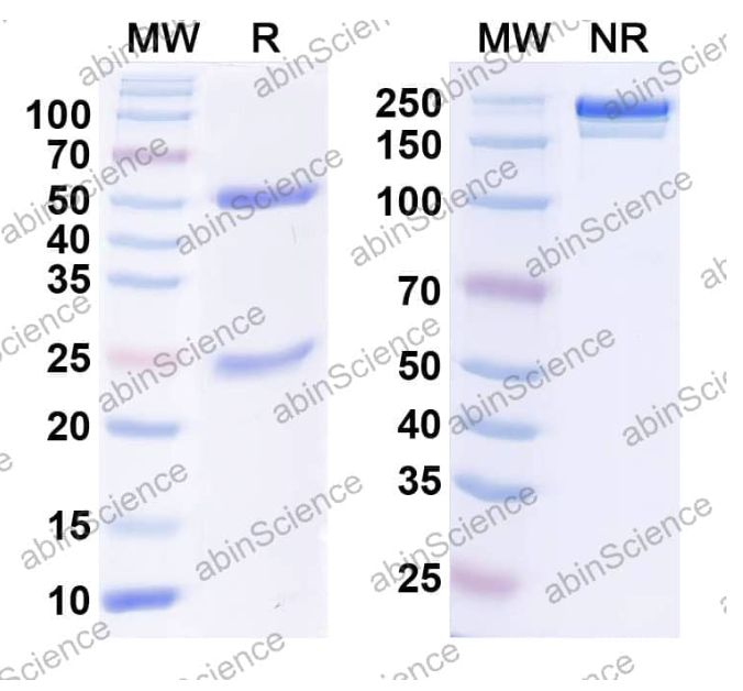 AbinScience InVivoMAb Anti-Human HLA-A*11:01 Antibody (2E3#) (HM834010-100UG) AbinScience InVivoMAb Anti-Human HLA-A*11:01 Antibody (2E3#) (HM834010-100UG)