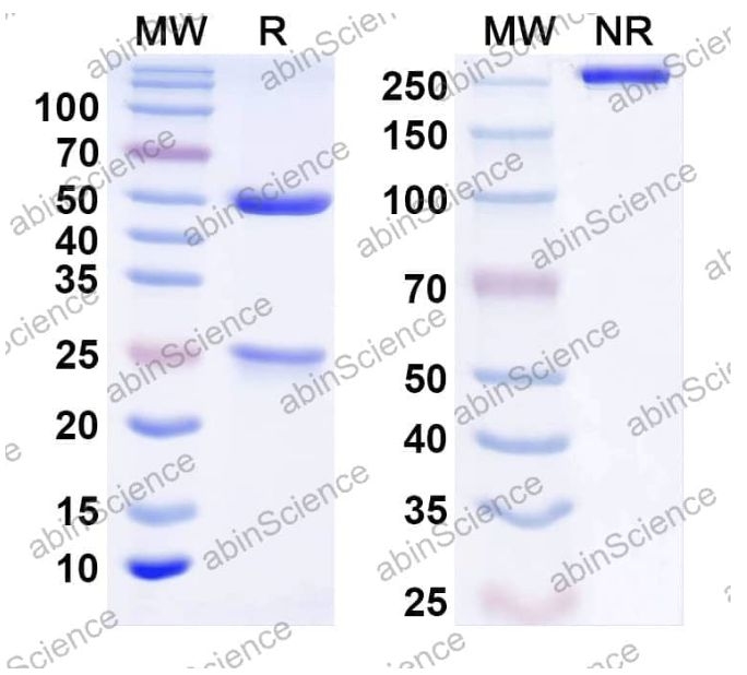 AbinScience InVivoMAb Anti-Human IFN-beta Antibody (Iv0199) (HF855010-100UG) AbinScience InVivoMAb Anti-Human IFN-beta Antibody (Iv0199) (HF855010-100UG)