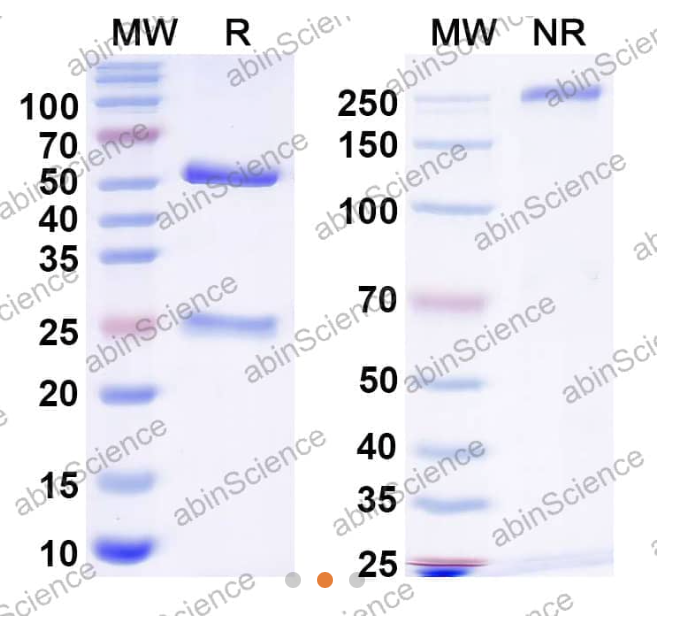 AbinScience InVivoMAb Anti-RSV F/Fusion glycoprotein F0 Antibody (RSV19) (VK421070-100UG)
