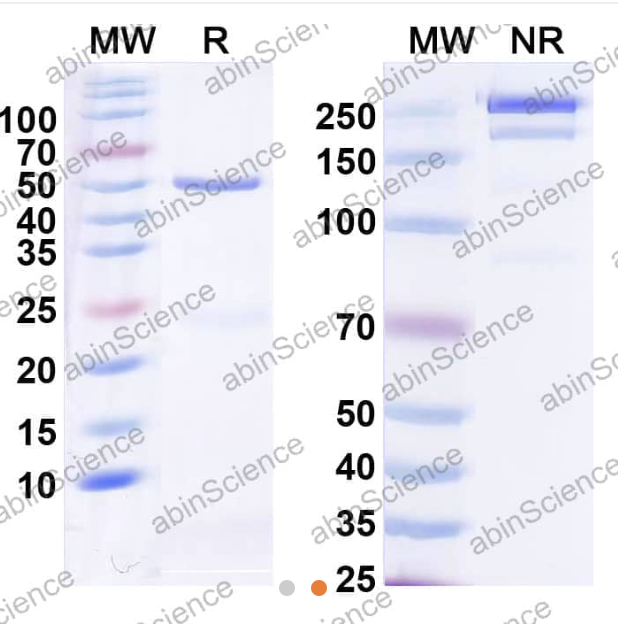 AbinScience InVivoMAb Anti-Human R-Spondin 3 Antibody (Iv0181) (HV514010-1MG)