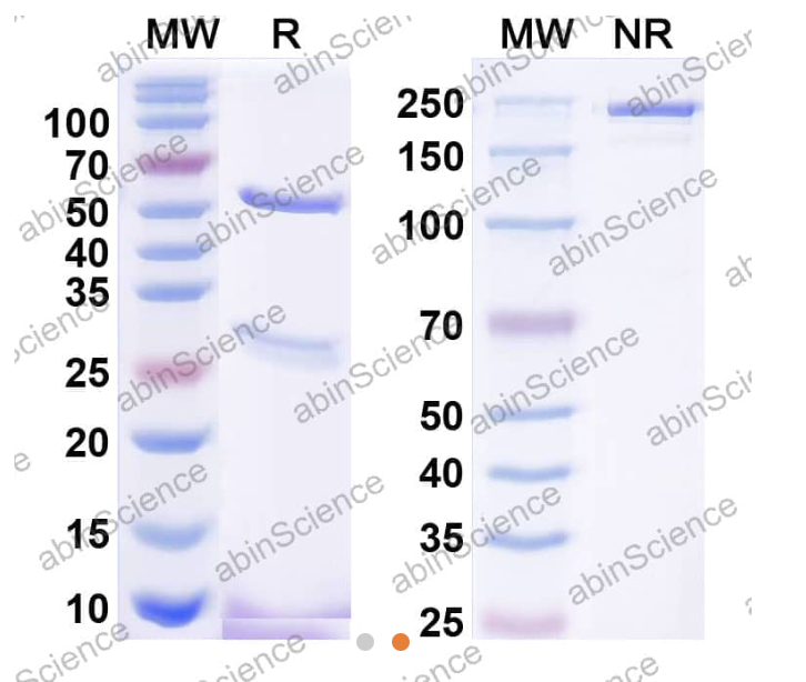 AbinScience InVivoMAb Anti-Human CA125/MUC16 Antibody (AR9.6) (HV601010-1MG)