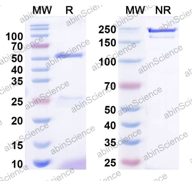 AbinScience InVivoMAb Anti-Human SOST/Sclerostin Antibody (Iv0185) (HV185010-100UG) AbinScience InVivoMAb Anti-Human SOST/Sclerostin Antibody (Iv0185) (HV185010-100UG)