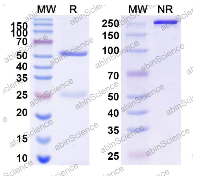 AbinScience InVivoMAb Anti-Nipah virus/NiV Prefusion Antibody (1H8) (VK521020-100UG) AbinScience InVivoMAb Anti-Nipah virus/NiV Prefusion Antibody (1H8) (VK521020-100UG)