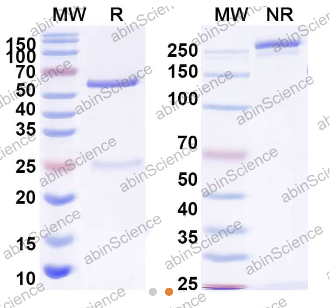 AbinScience InVivoMAb Anti-HBV-A S/L-HBsAg/L glycoprotein Antibody (Iv0153) (VK539020-50UG)