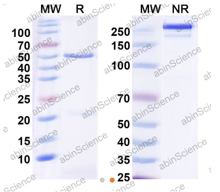 AbinScience InVivoMAb Anti-Human STEAP1 Antibody (Iv0158) (HV409010-1MG)