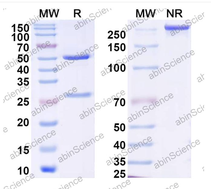 AbinScience InVivoMAb Anti-EBV/HHV4 gB/BALF4 Antibody (Iv0134) (VK799020-1MG) AbinScience InVivoMAb Anti-EBV/HHV4 gB/BALF4 Antibody (Iv0134) (VK799020-1MG)